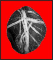 �������� ����� - ����� ����� �������� (1956 � 1991)